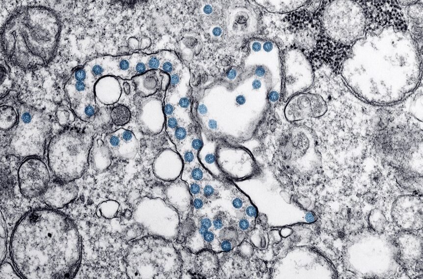 where can avoid vezyolatens